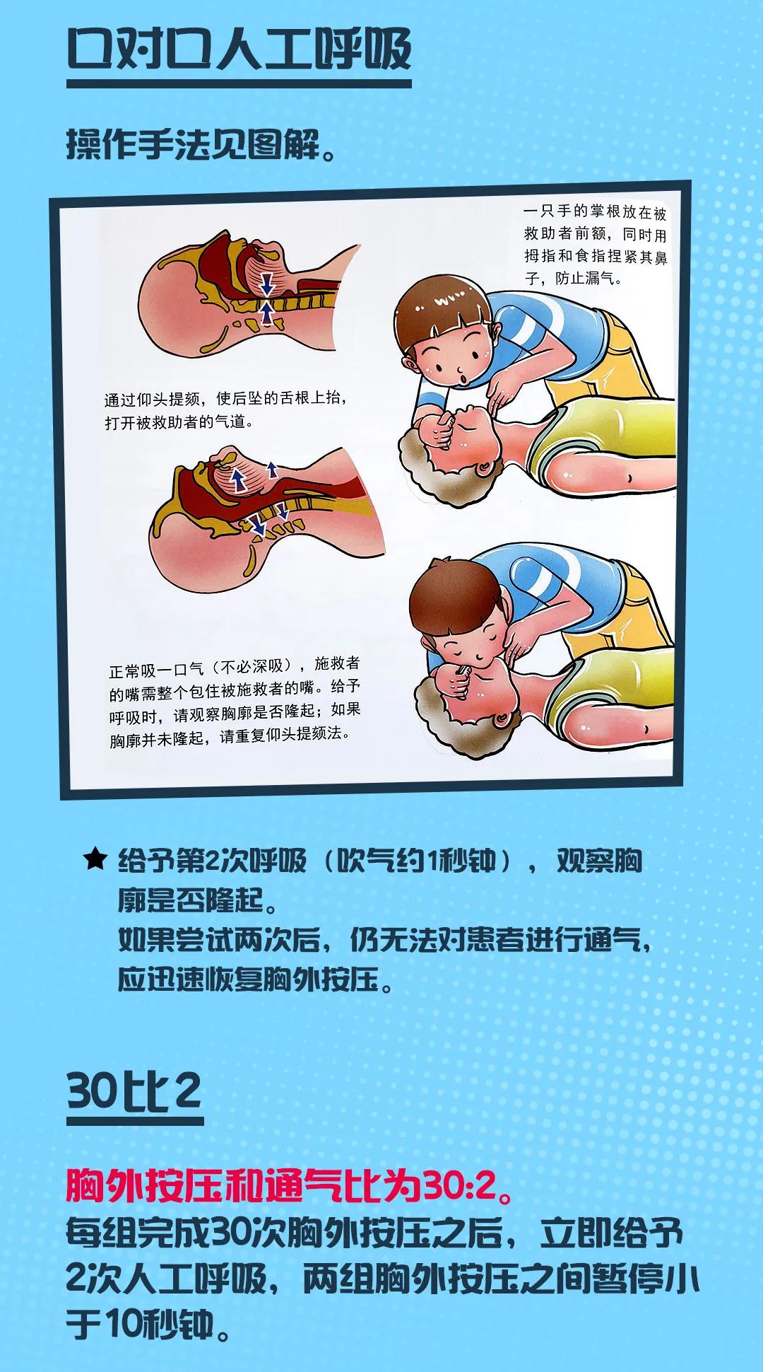 保护儿童安全图说科普心肺复苏的操作要点