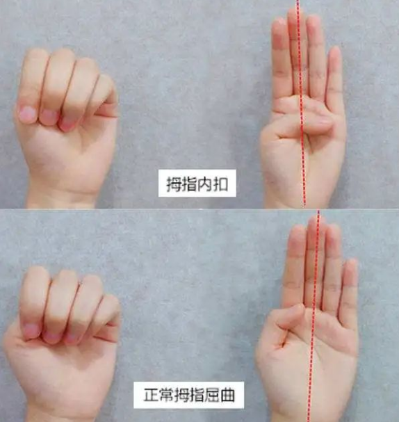 不经意握拳竟能凝神养肝气